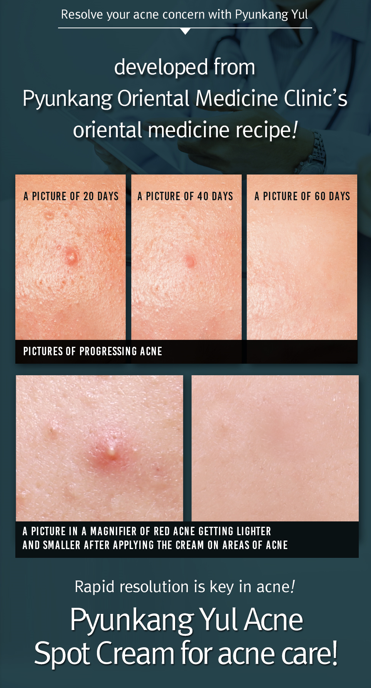 ACNE Spot Cream 15ml / 0.50 Fl. Oz