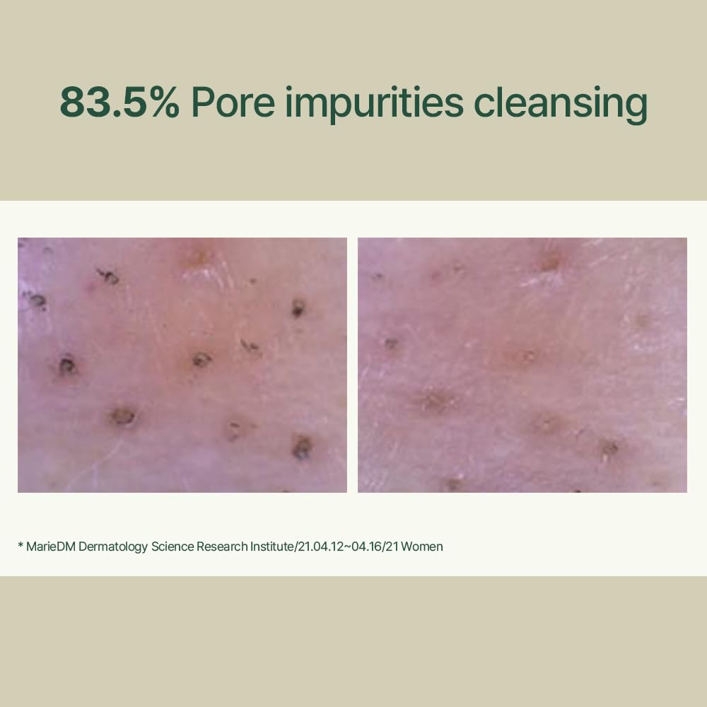 Calming Low pH Foaming Cleanser  5.07 Fl. Oz / 150ml