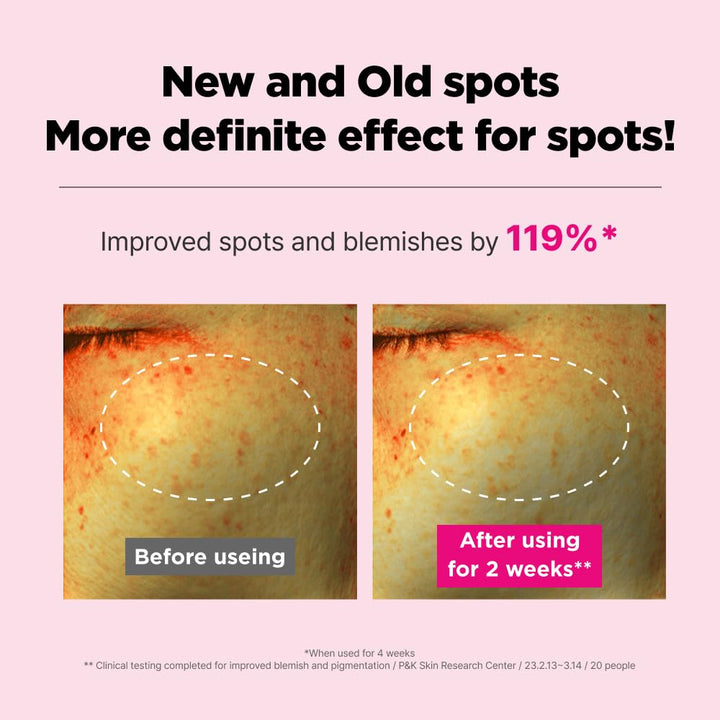 Blemish Care Up Cream 55ml / 1.86 fl.oz