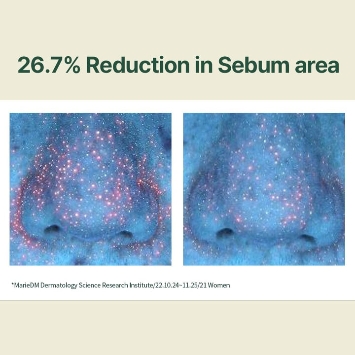 Calming Moisture Serum 1.01 Fl. Oz, / 30ml