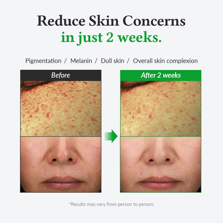 Gentle Vitamin C 20% Serum, 30ml / 1.01 fl.oz.