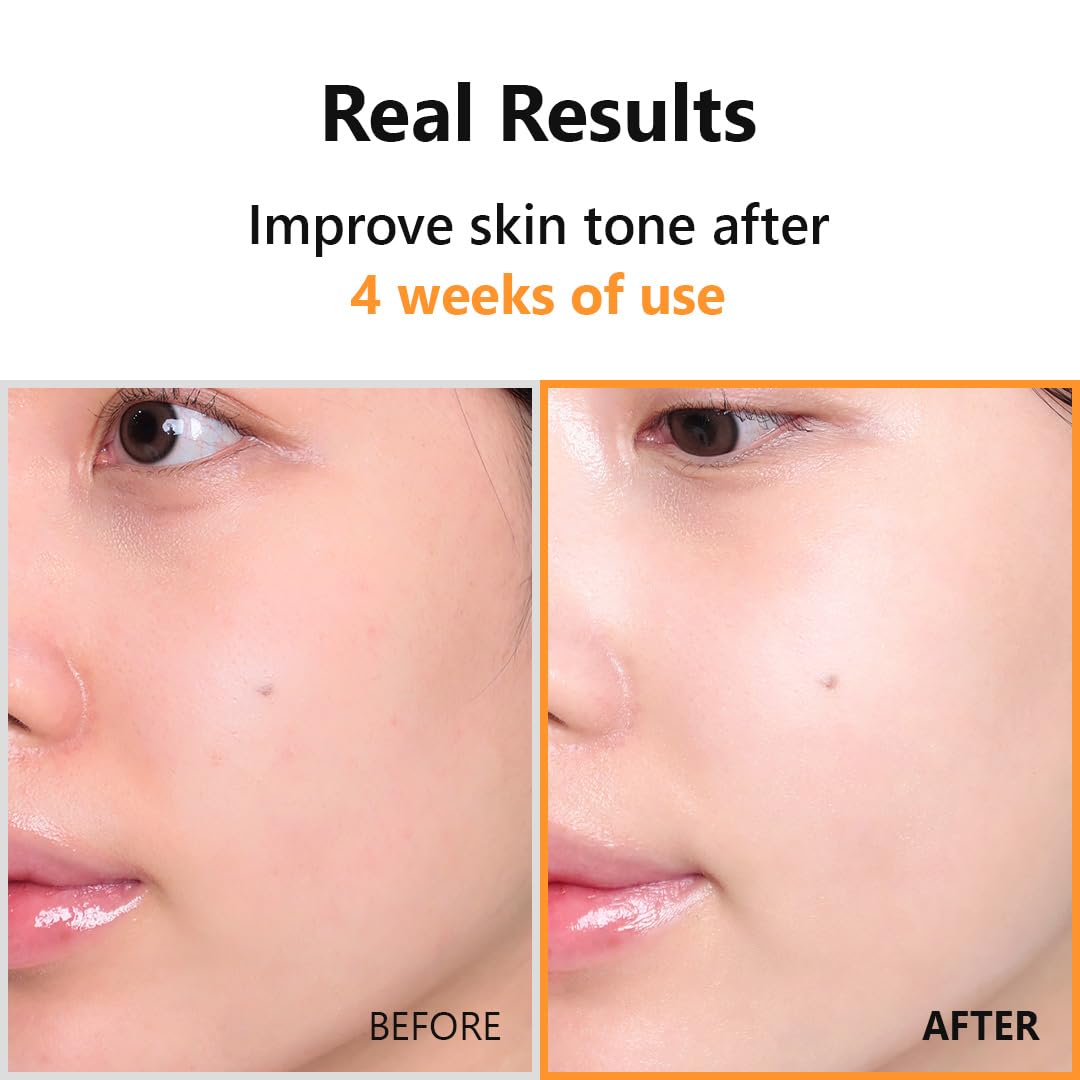 Hyper Vitamin C 23 Serum 20ml / 0.67 fl. oz.