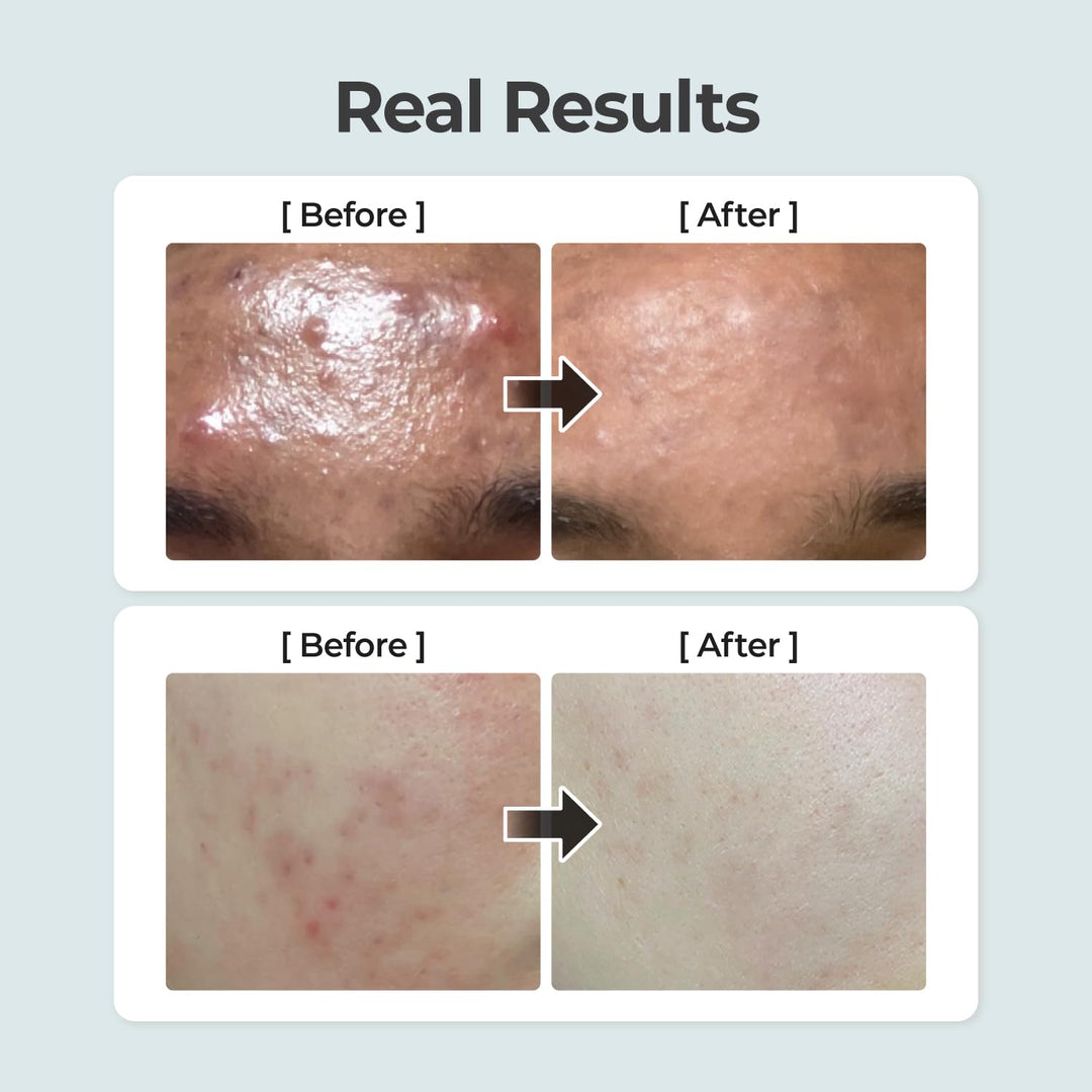 No.1 Pure-Full Calming Herb Toner 300ml / 10.14 fl. oz