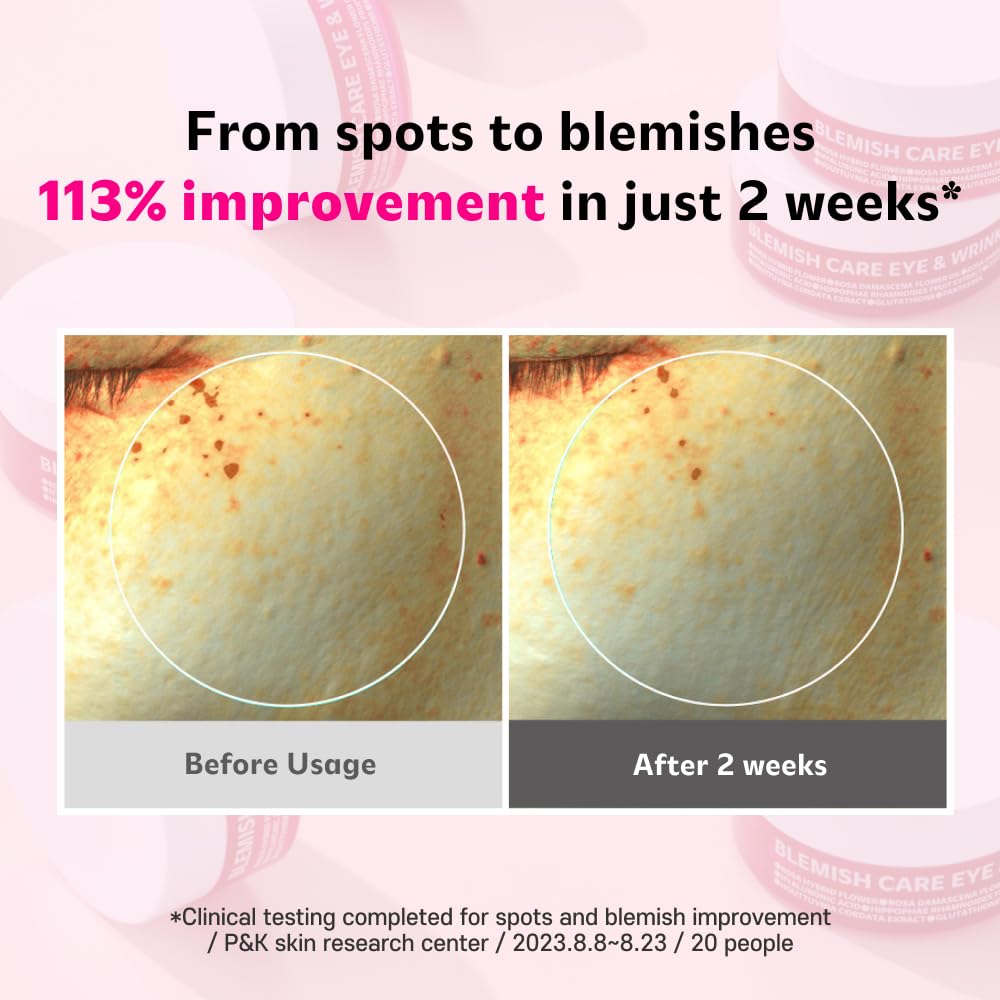 Blemish Care Eye & Wrinkle Patch 90g / 90pcs