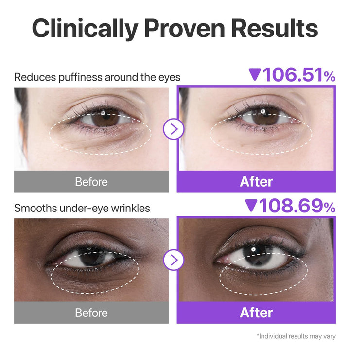 No.9 NAD+ Collagen Under Eye Patches 10 Patches / 5 pairs