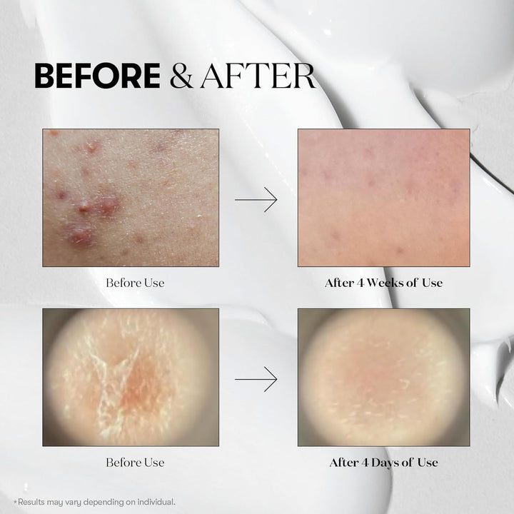 CICA Reedle Shot 700 1Fl Oz 30ml / 1.01 fl. oz.