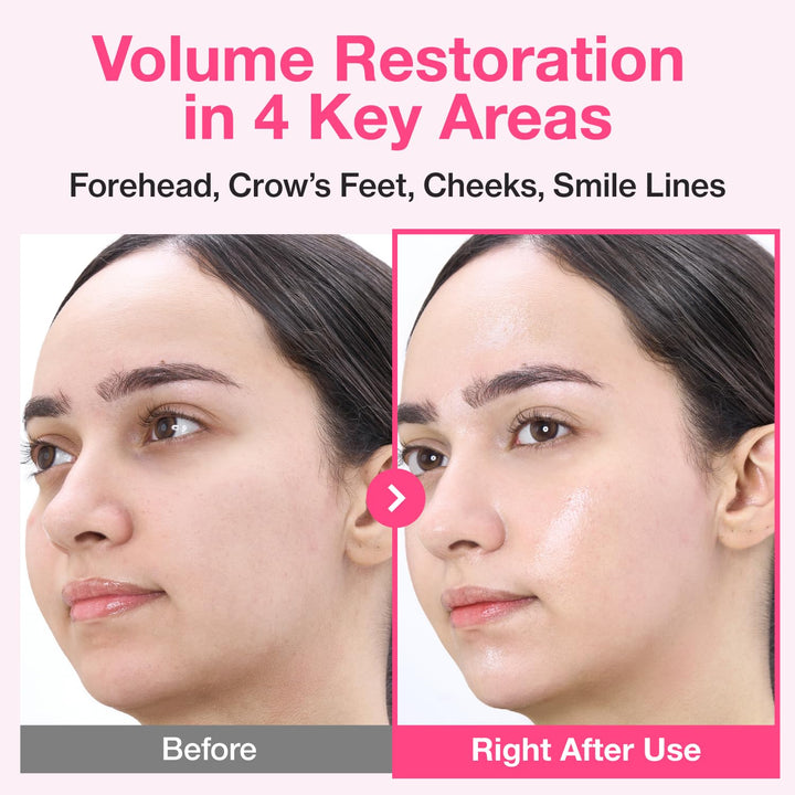 No.2 Rose PDRN Collagen Plumping Sheet Mask 5pks