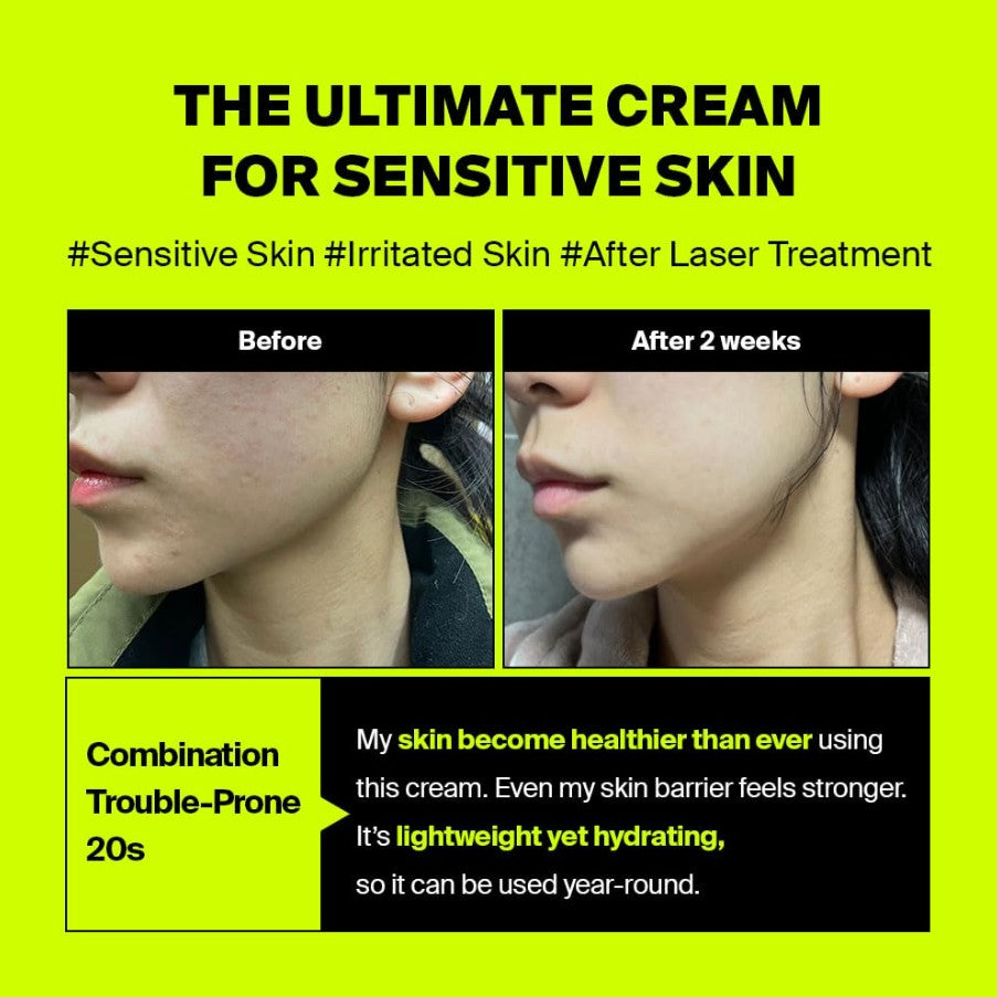 After Laser Rebooting Cream 1.69 fl. oz. / 50ml