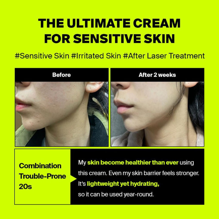 After Laser Rebooting Cream 1.69 fl. oz. / 50ml