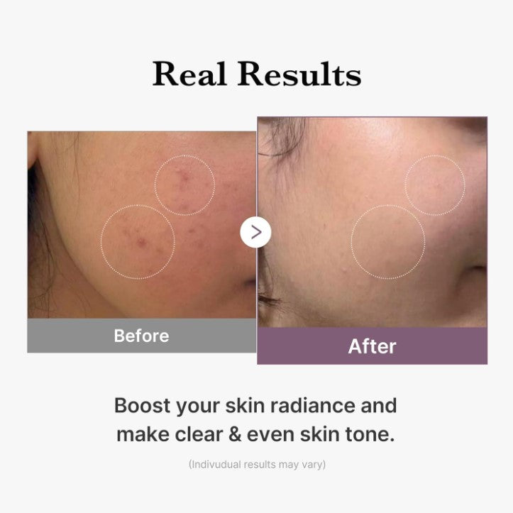 Age-R Glutathione Glow Milky Toner 140ml / 4.73 fl. oz.