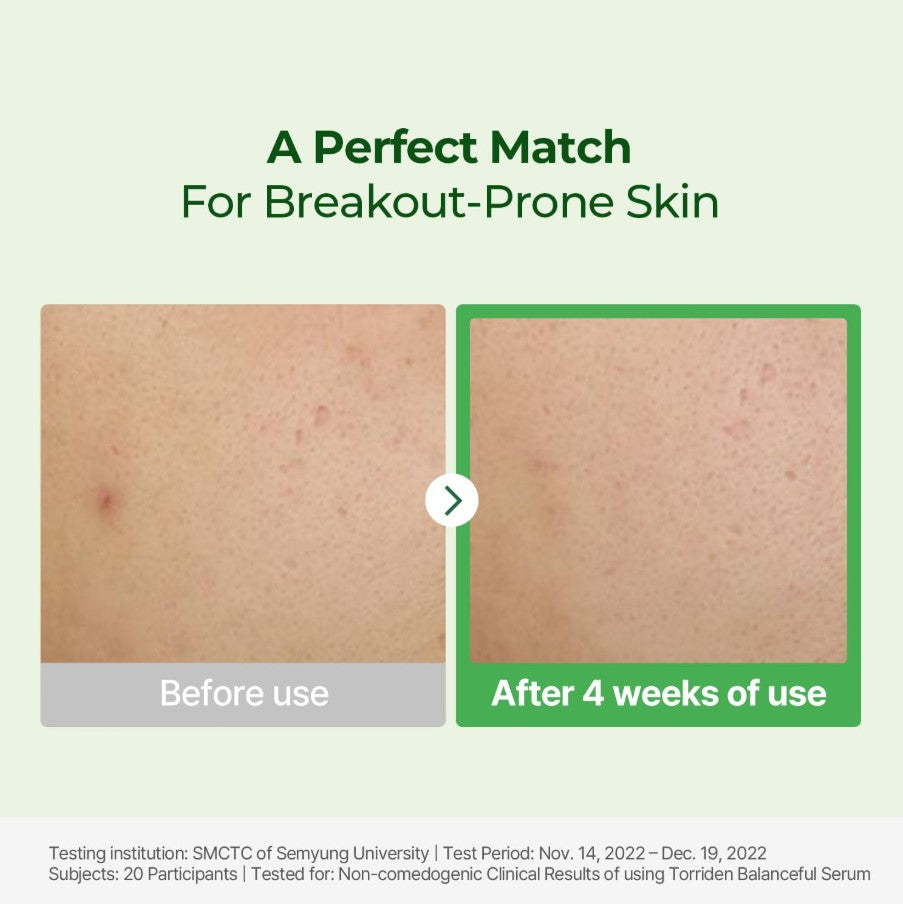 BALANCEFUL Serum 50ml / 1.69 fl.oz. 2pk