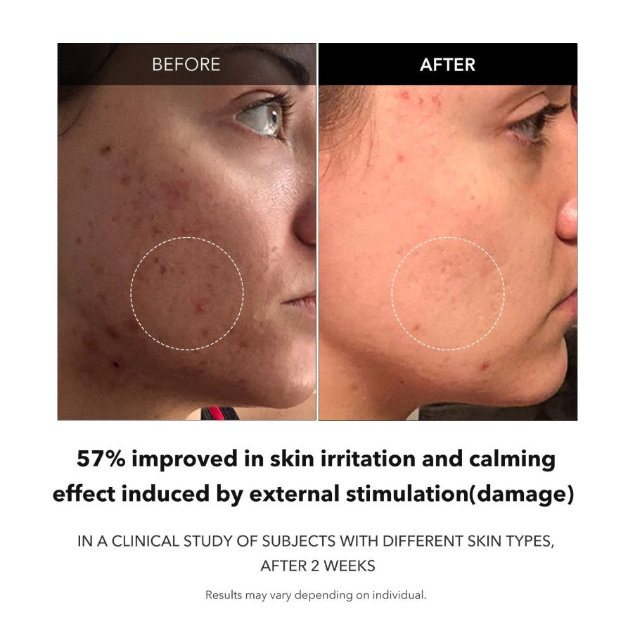 Carrotene Clarifying Facial Serum 1.25 fl. oz. / 37ml