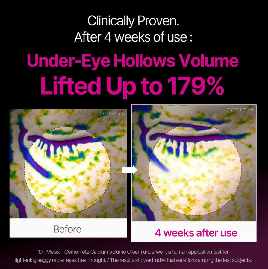 Cemenrete Calcium Intense Cream 50ml / 1.69 fl. oz.