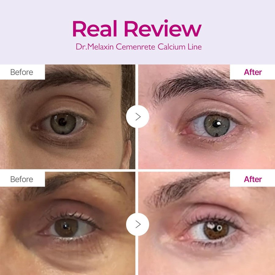 Cemenrete Calcium Intense Cream 50ml / 1.69 fl. oz.