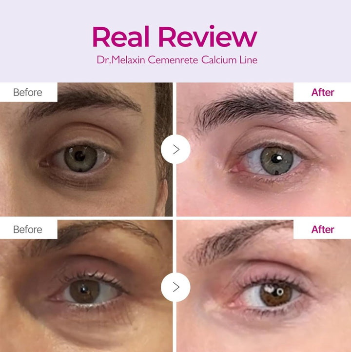 Cemenrete Calcium Intense Cream 50ml / 1.69 fl. oz.