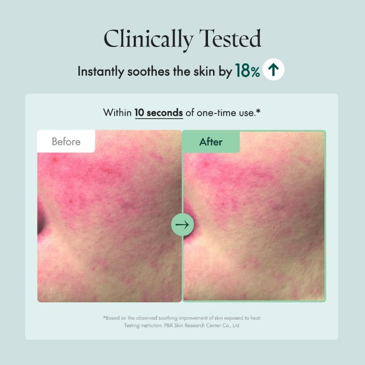 Wonder Releaf Centella Serum 60ml / 1.69 fl. oz.