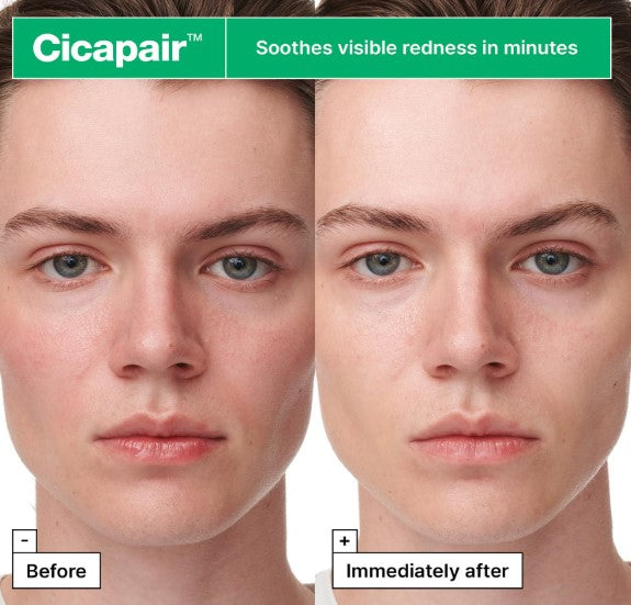 Cicapair Intensive Soothing Repair Serum Mask (5ea)