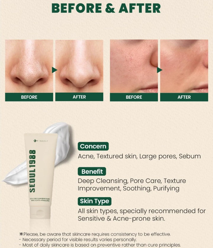 SEOUL 1988 Cleansing Foam : Pine Cica 1% + Probiotics 150ml / 5.07 fl. oz.