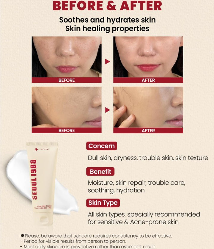 SEOUL 1988 Cream : Snail Mucin 93% + Rice, 100ml / 3.38fl.oz.