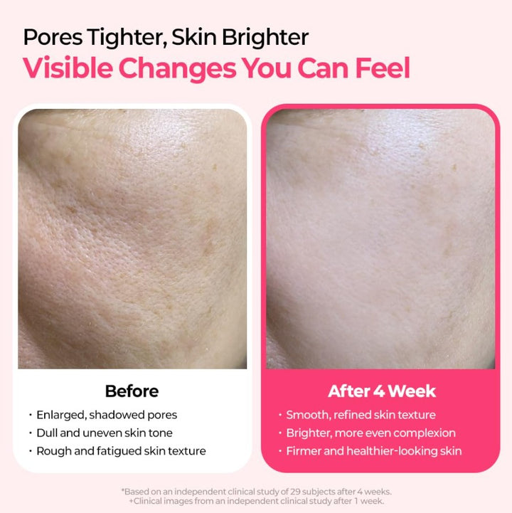 Cemenrete Cyano Pink Spicule Serum 30ml / 1.01 fl. oz.