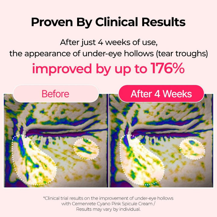 Cemenrete Cyano Pink Spicule Cream 50ml / 1.69 fl. oz.