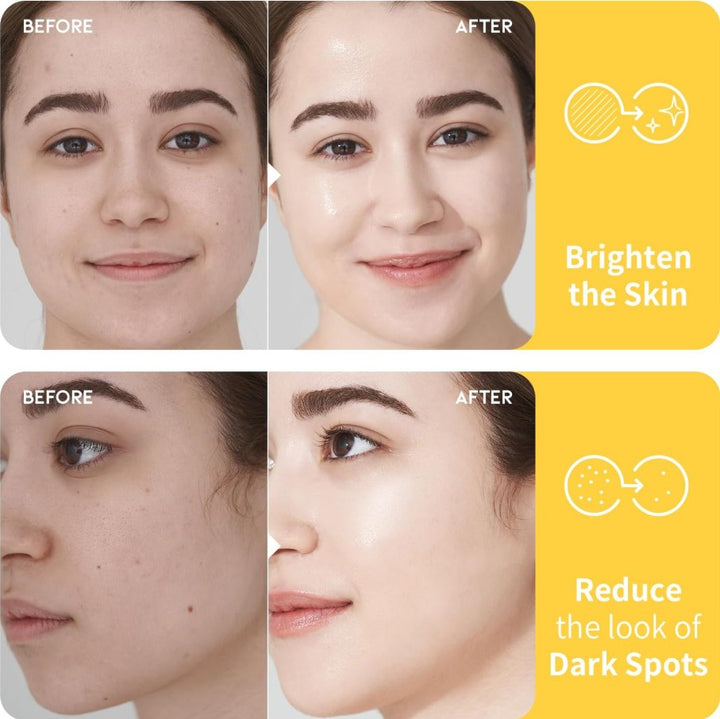 Dark Spot Vitamin C Toner 8.45 fl. oz. / 250ml