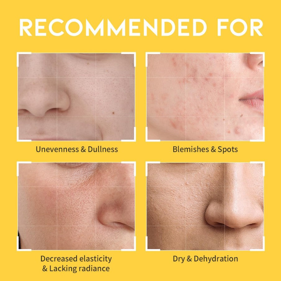 Dark Spot Vitamin C Toner 8.45 fl. oz. / 250ml