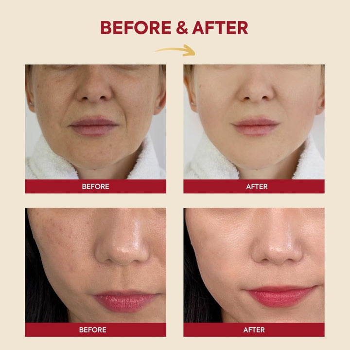 SEOUL 1988 Essence : Snail Mucin 97% + Rice 100ml / 3.38 fl. oz.