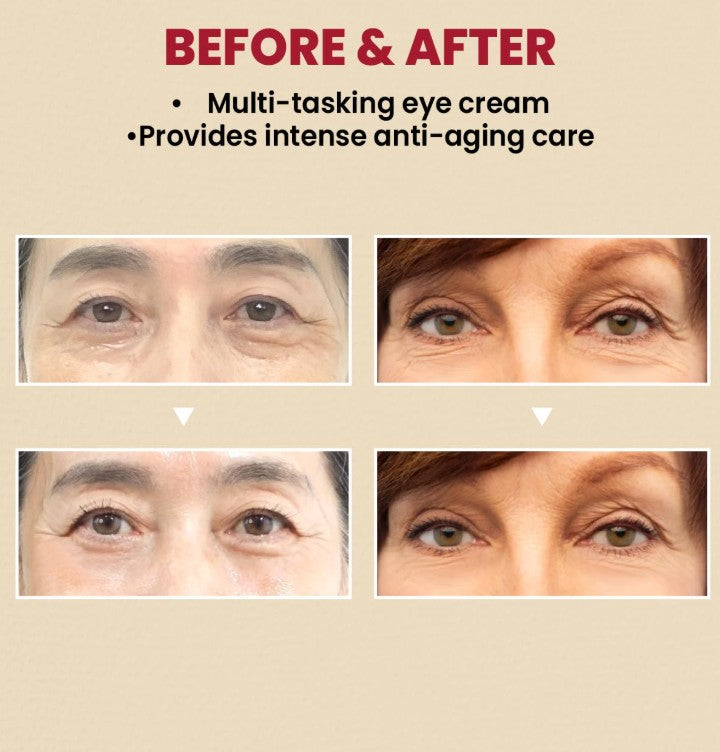 SEOUL 1988 Eye Cream : Retinal Liposome 4% + Fermented Bean, 30ml / 1.01 fl.oz.