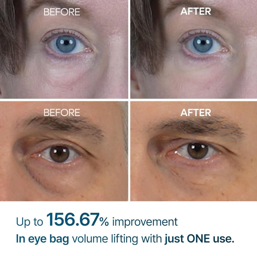 Eyephalt Eyebag Cream 10ml