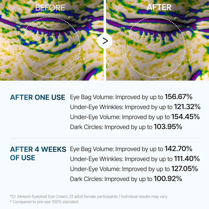 Eyephalt Eyebag Cream 10ml