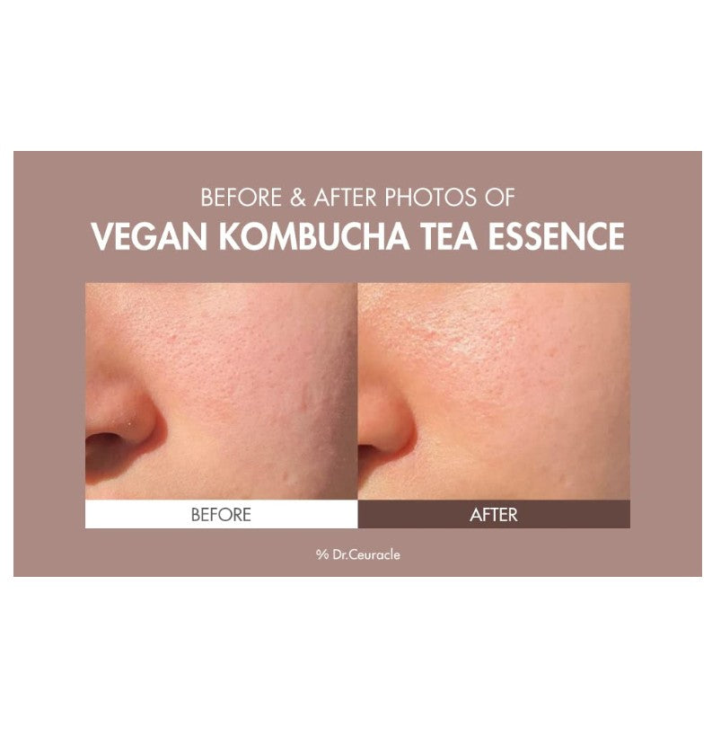 Vegan Kombucha Tea Essence 5.07 fl.oz. / 150ml