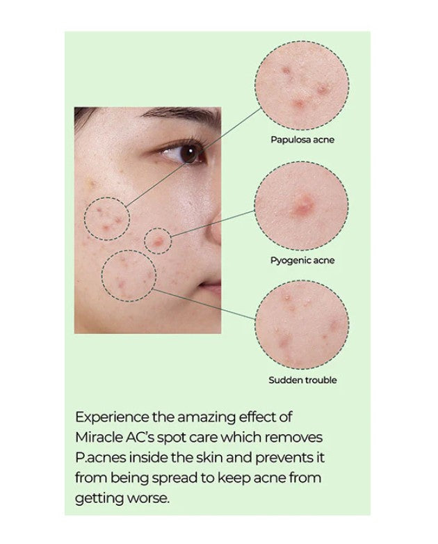 Miracle AC Clear Spot Treatment 10ml