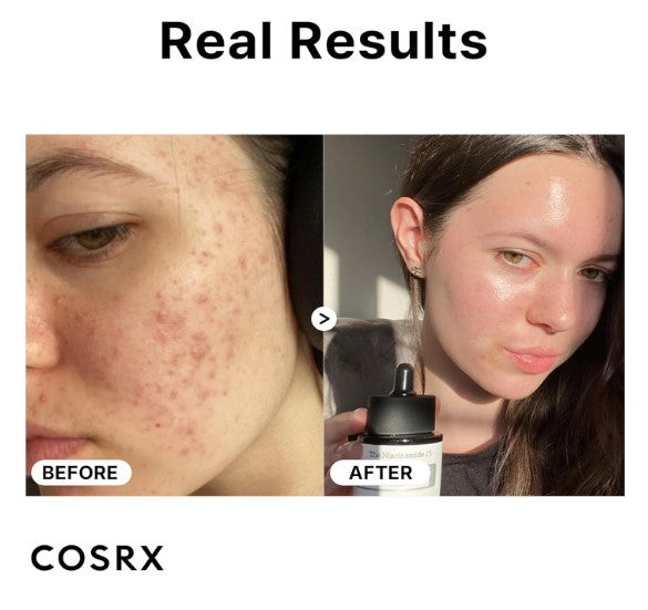 15% Niacinamide Face Serum 20ml / 0.67 fl. oz.