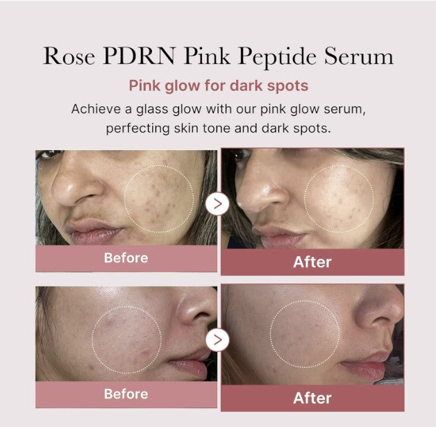 PDRN Peptide Serum Rose PDRN 30ml / 1.01 fl. oz.
