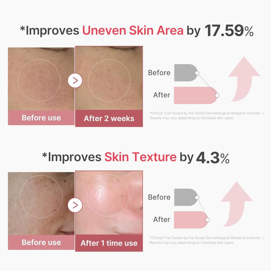 PDRN Pink Collagen Exosome Shot 2000 Serum 30ml / 1.01 fl. oz.