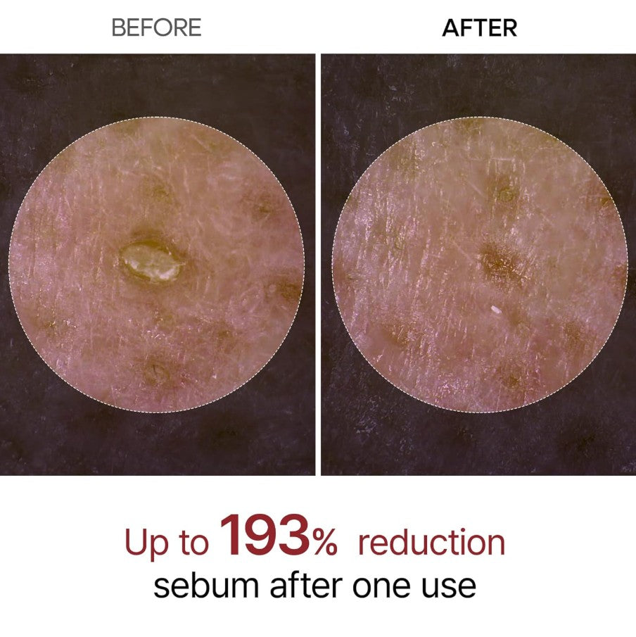 Peel Shot Glow Black Rice Peeling Ampoule 80ml / 2.7 fl. oz.