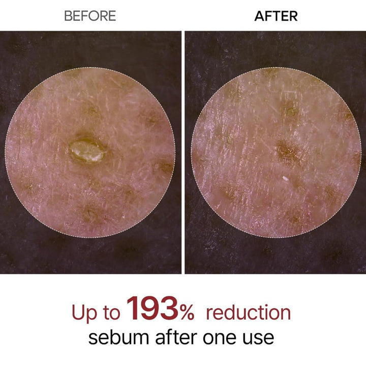 Peel Shot Glow Black Rice Peeling Ampoule 80ml / 2.7 fl. oz.