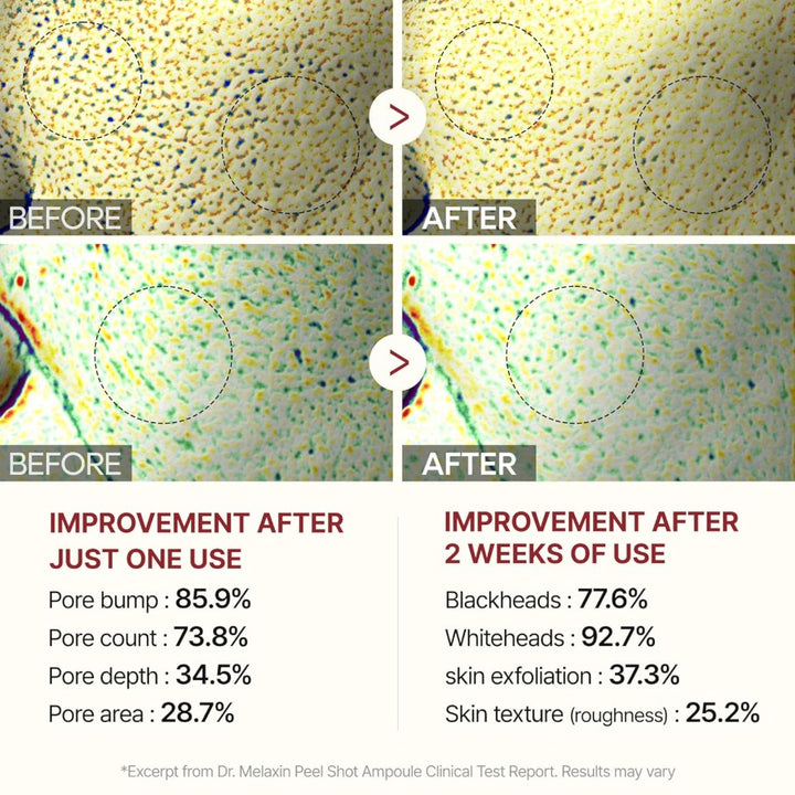 Peel Shot Glow Black Rice Peeling Ampoule 80ml / 2.7 fl. oz.