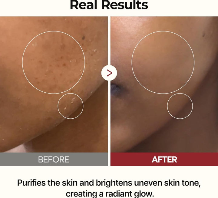 Peel Shot glowe Rice Toner 200ml / 6.76 fl. oz.