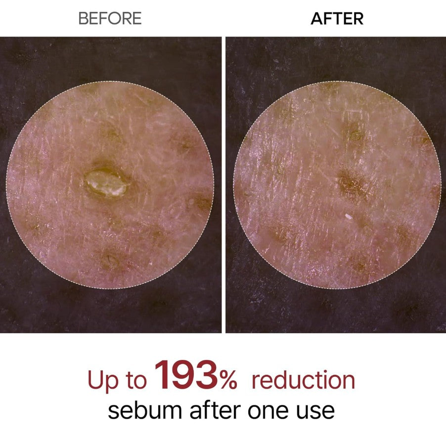 Peel Shot Glow White Rice Peeling Ampoule 80ml / 2.7 fl. oz.