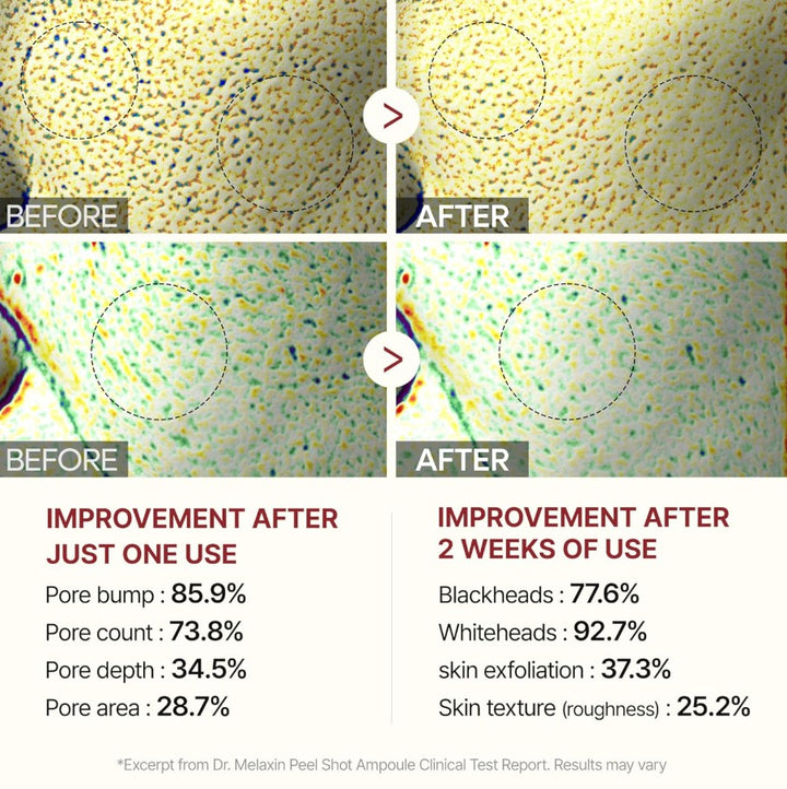 Peel Shot Glow White Rice Peeling Ampoule 80ml / 2.7 fl. oz.