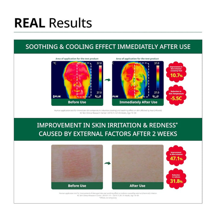 R.E.D Blemish Clear Soothing Active Essence 80ml