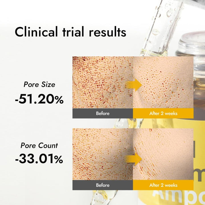 Real Vitamin C Ampoule 1.01 fl. oz / 30ml