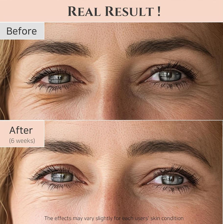 Revive Eye Serum : Ginseng + Retinal 30ml / 1 fl. oz.