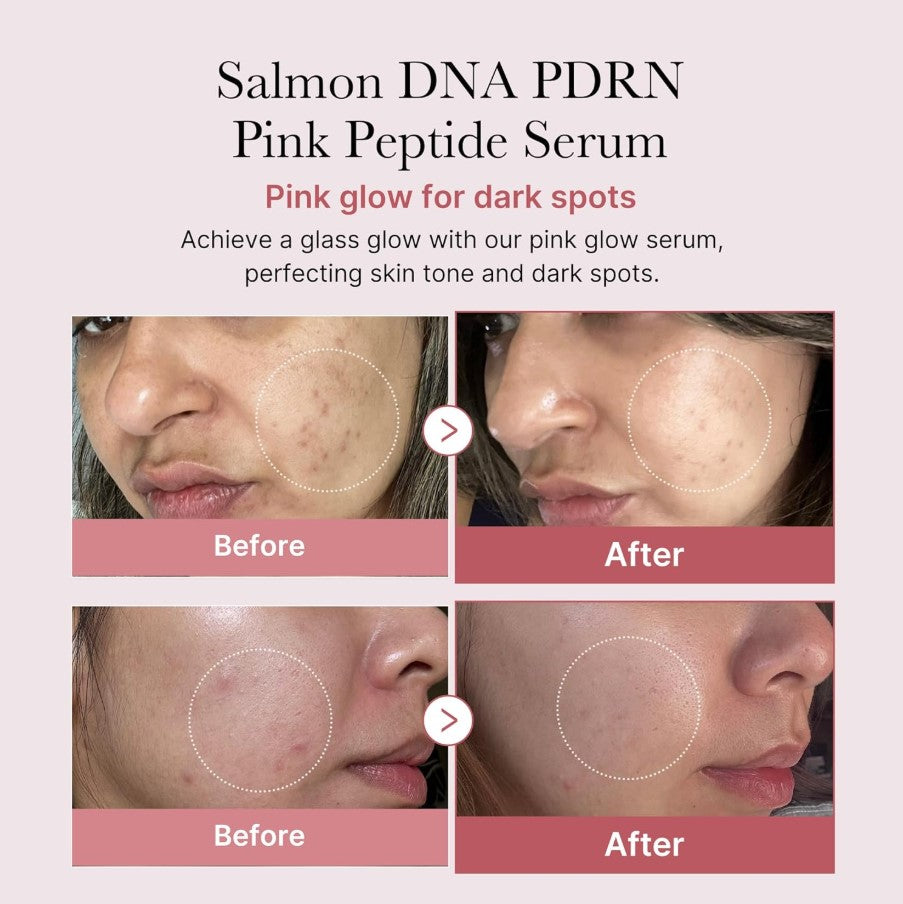 PDRN Peptide Serum Salmon DNA PDRN 30ml / 1.01 fl. oz.