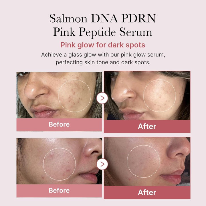 PDRN Peptide Serum Salmon DNA PDRN 30ml / 1.01 fl. oz.