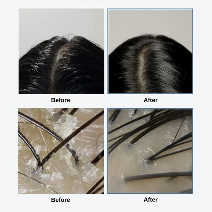 Sea Salt Therapy Scalp Scaler 4.23 fl. oz. / 120ml