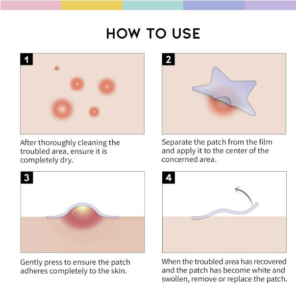 Star Spot Acne / Pimple Patch 80 Counts