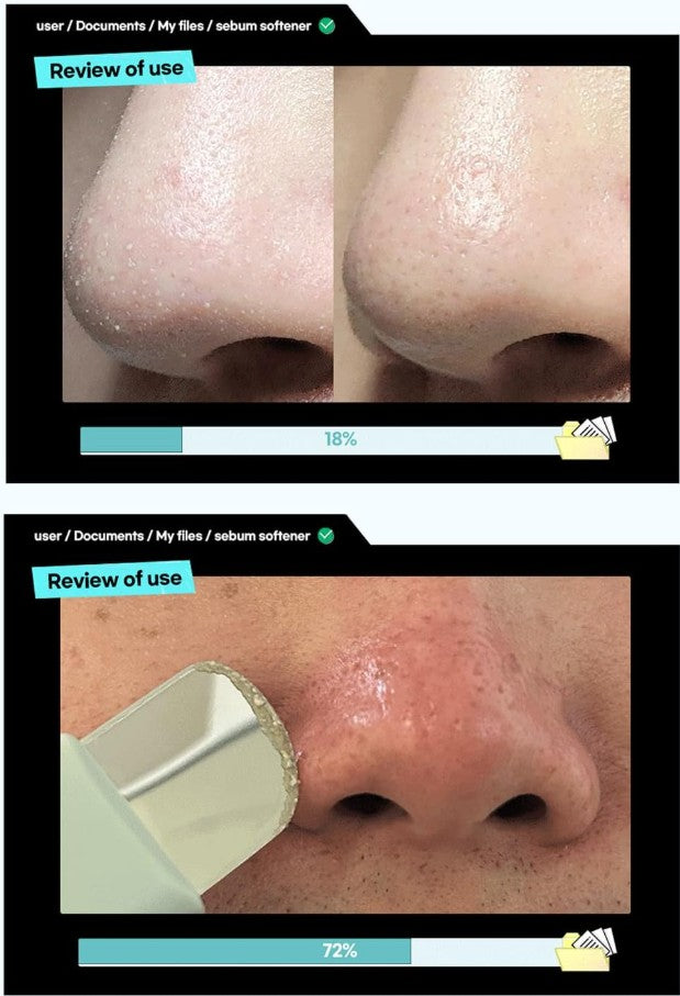 Super Melting Sebum Softener 150ml / 5.29 fl. oz.